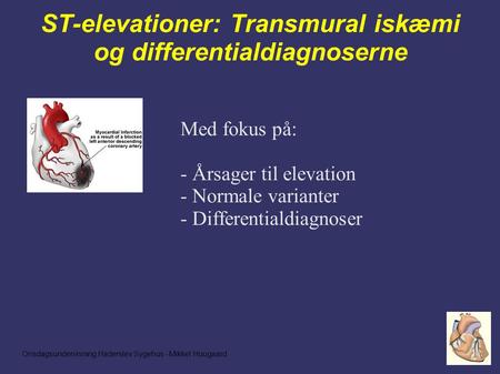 Onsdagsundervisning Haderslev Sygehus - Mikkel Hougaard ST-elevationer: Transmural iskæmi og differentialdiagnoserne Med fokus på: - Årsager til elevation.