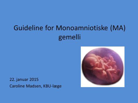 Guideline for Monoamniotiske (MA) gemelli