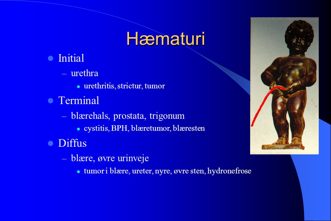 Hæmaturi Initial Terminal Diffus urethra blærehals, prostata, trigonum