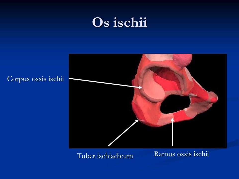 Os ischii Corpus ossis ischii Ramus ossis ischii Tuber ischiadicum
