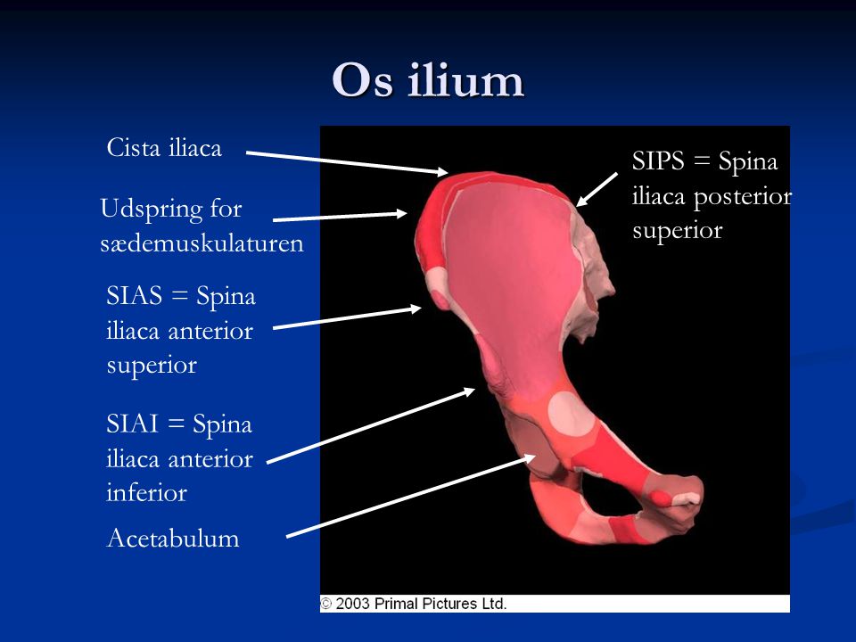 Os ilium Cista iliaca SIPS = Spina iliaca posterior superior