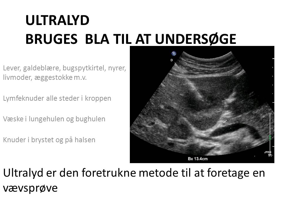 ULTRALYD BRUGES BLA TIL AT UNDERSØGE