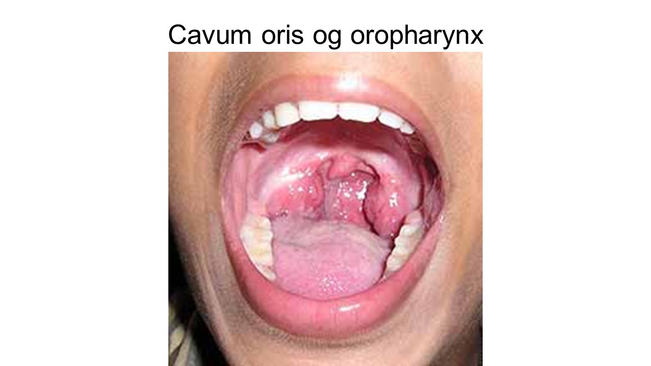 Cavum oris og oropharynx