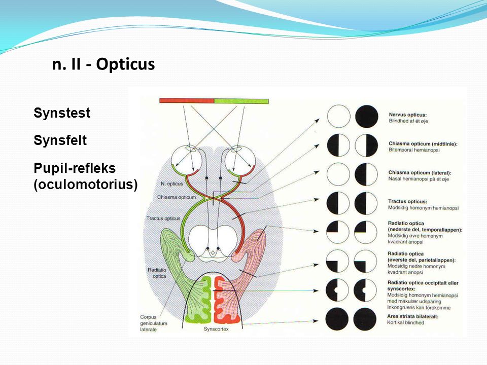n. II - Opticus Synstest Synsfelt Pupil-refleks (oculomotorius)