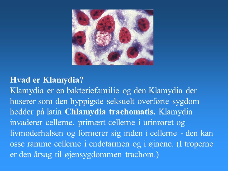 Mænd klamydia symptomer Klamydia (medicin