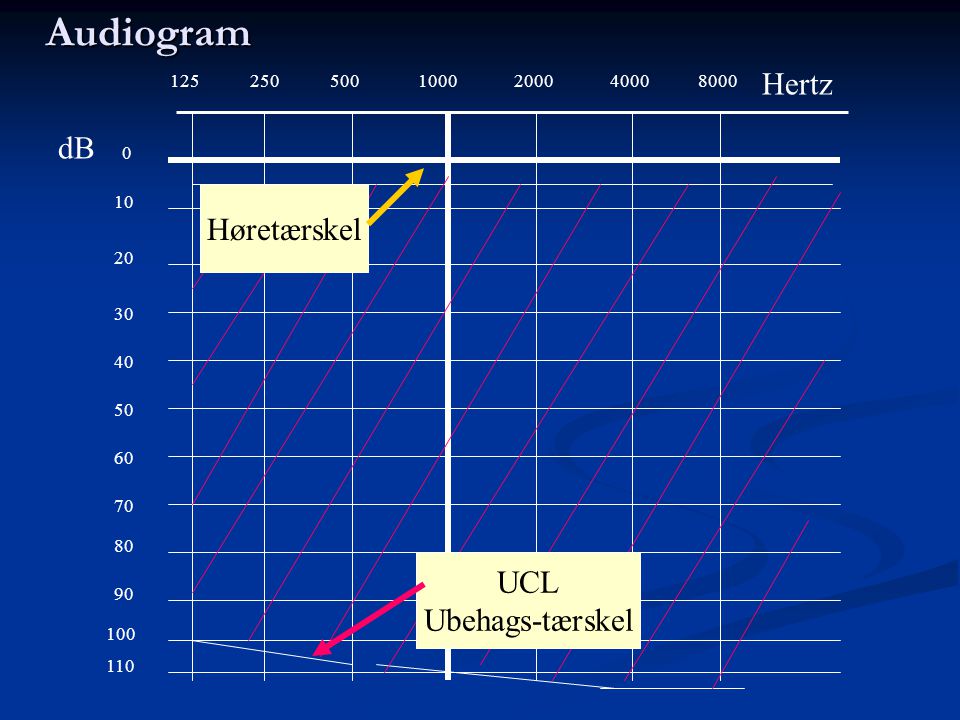 Audiogram Hertz dB Høretærskel UCL Ubehags-tærskel