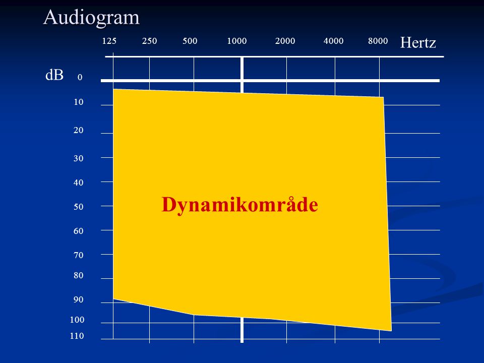 Audiogram Dynamikområde Hertz dB