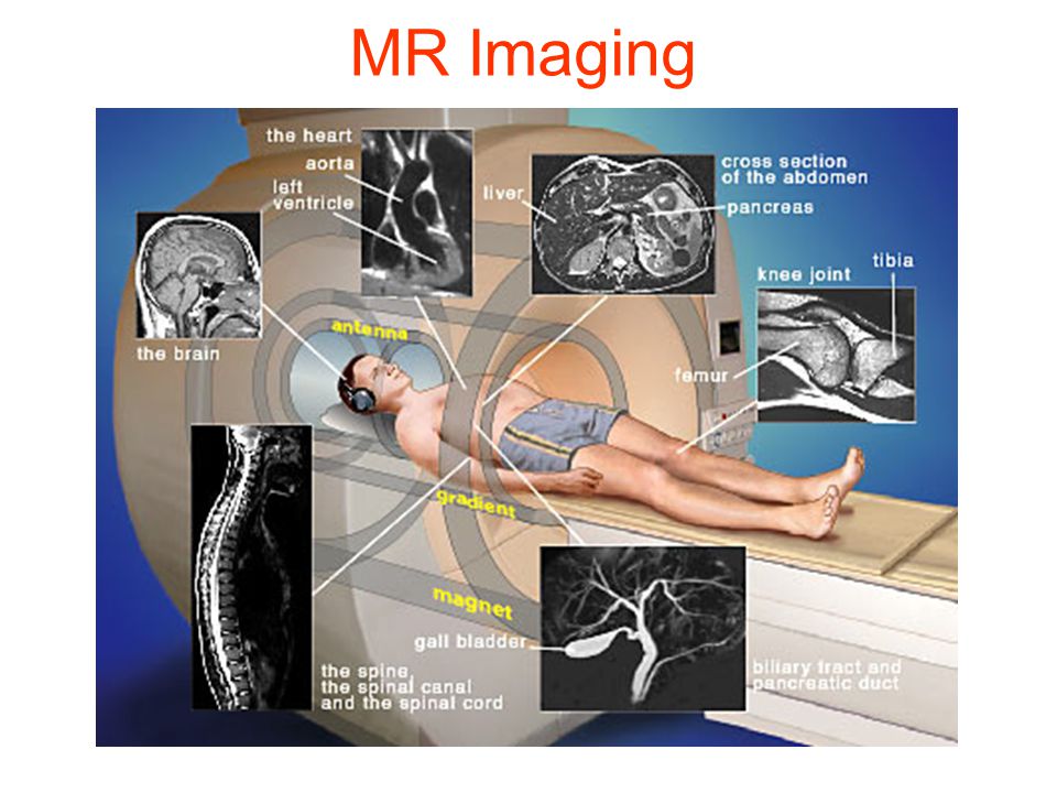 MR Imaging