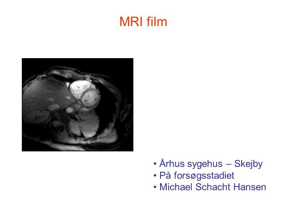 MRI film Århus sygehus – Skejby På forsøgsstadiet