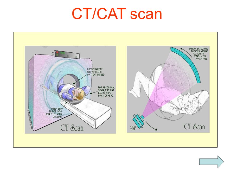 CT/CAT scan
