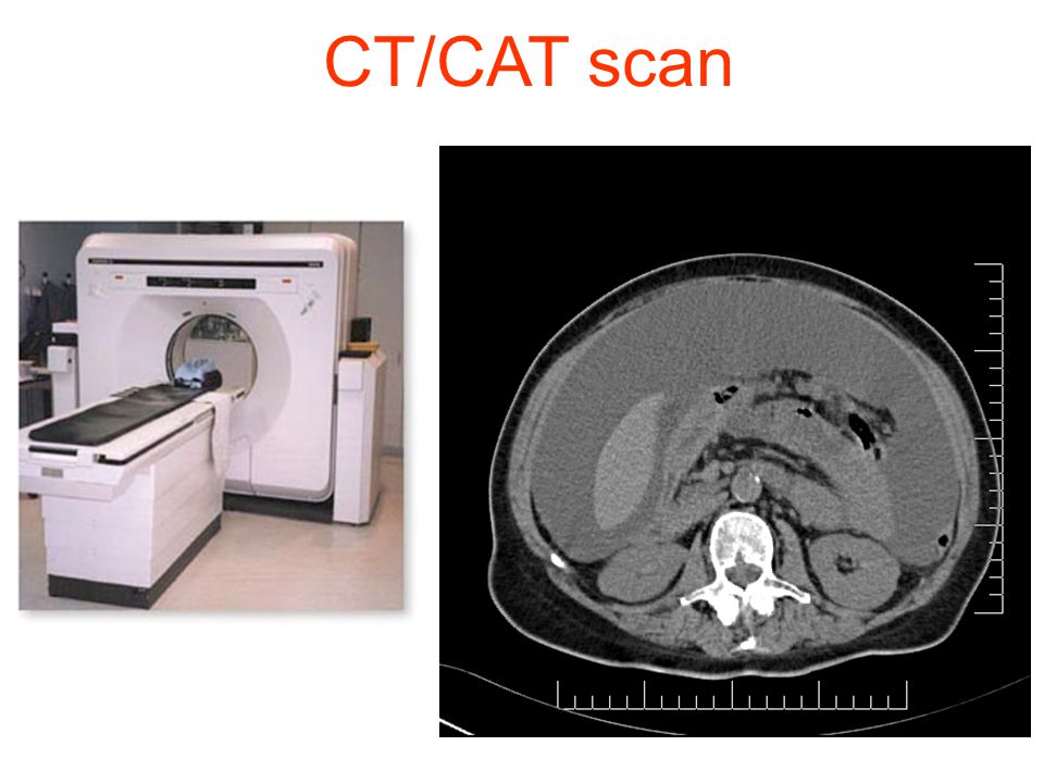 CT/CAT scan