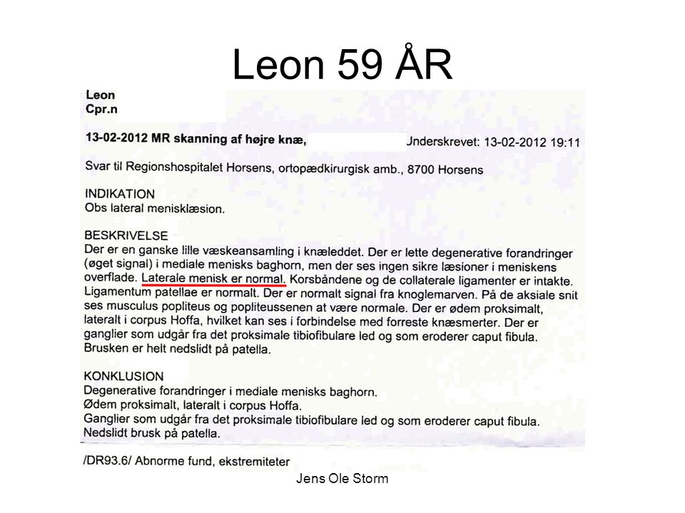 Leon 59 ÅR Jens Ole Storm