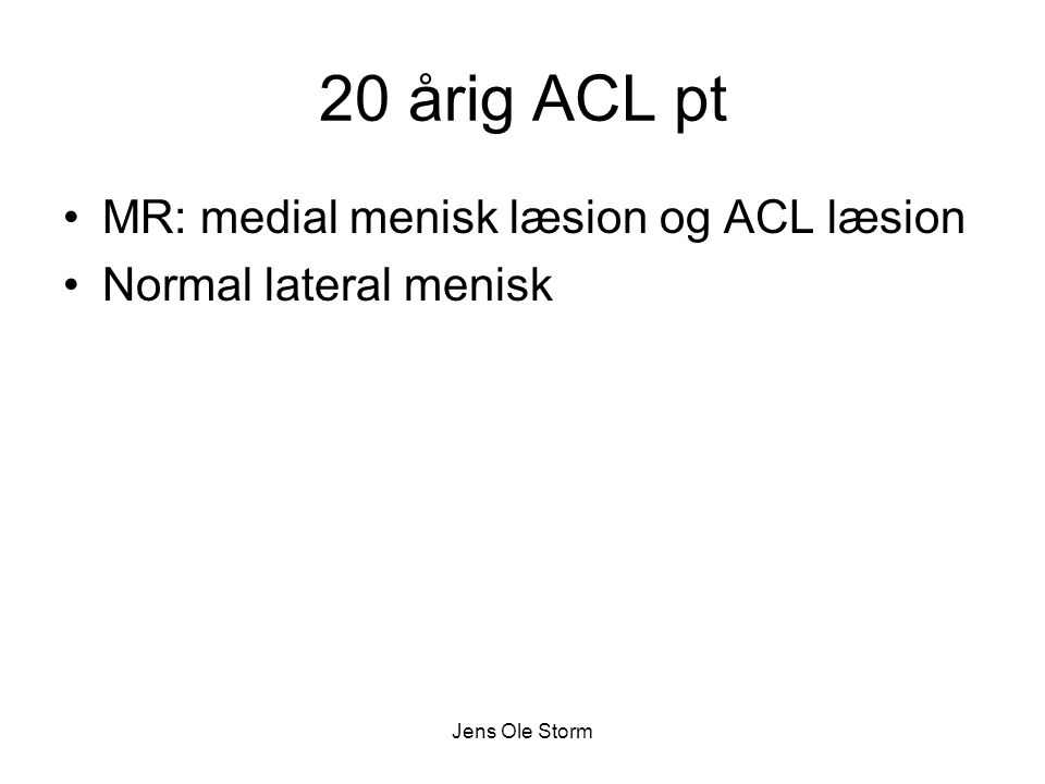 20 årig ACL pt MR: medial menisk læsion og ACL læsion