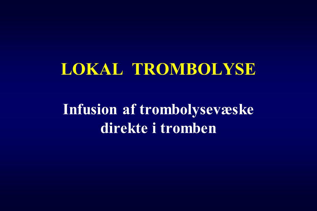 LOKAL TROMBOLYSE Infusion af trombolysevæske direkte i tromben