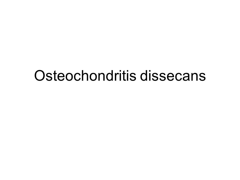 Osteochondritis dissecans