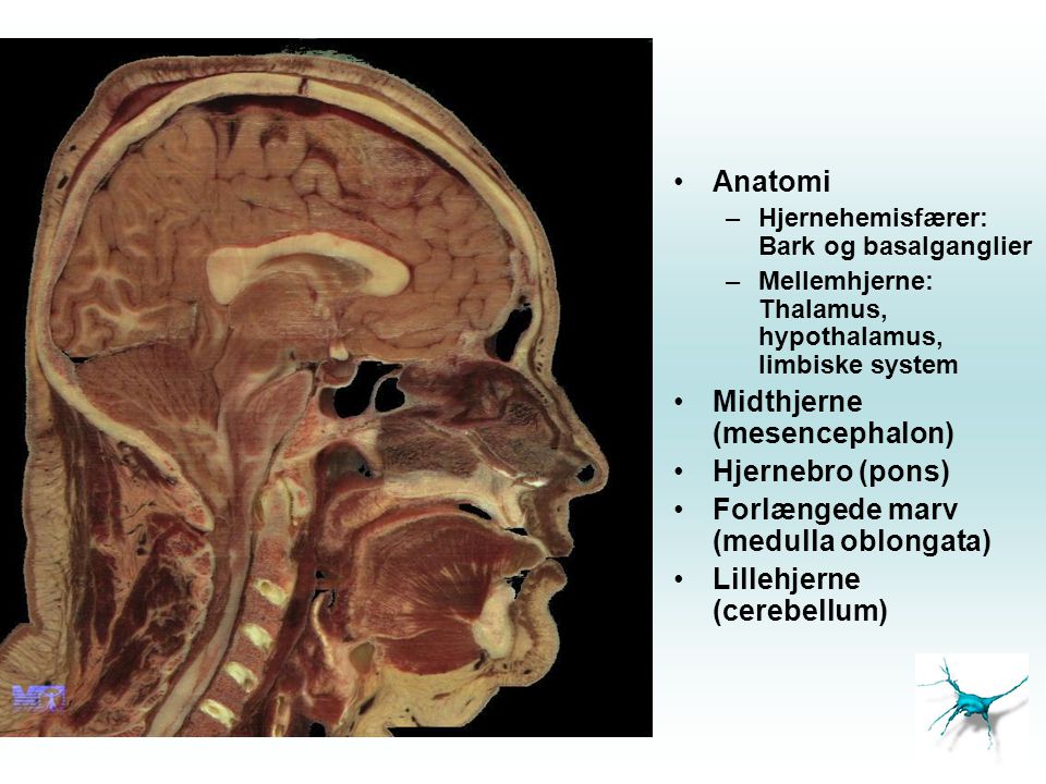 Midthjerne (mesencephalon) Hjernebro (pons)