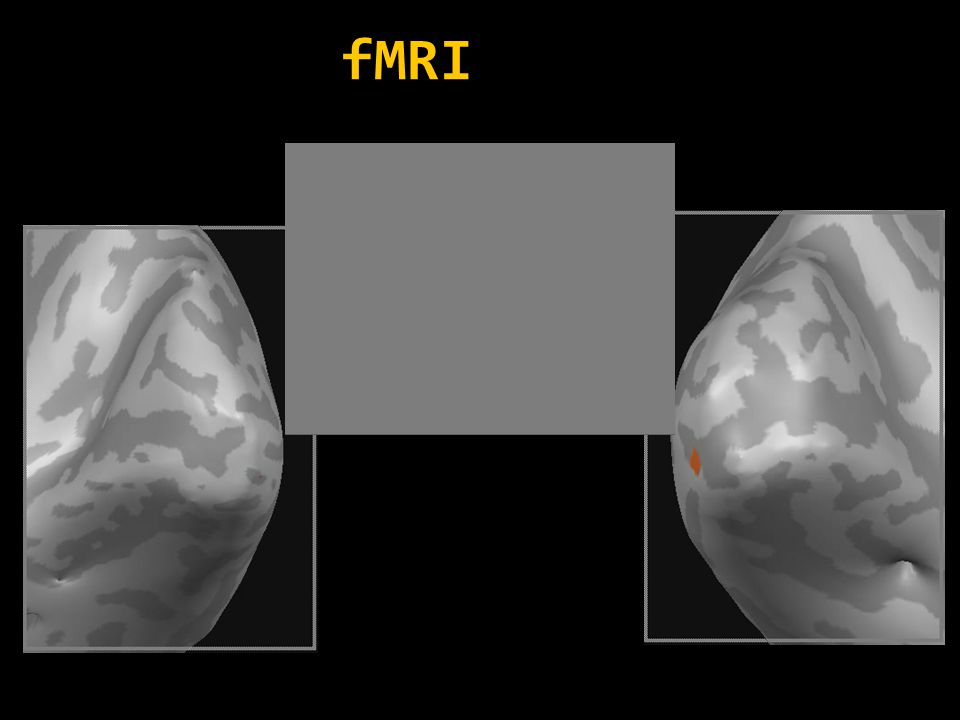 fMRI 24
