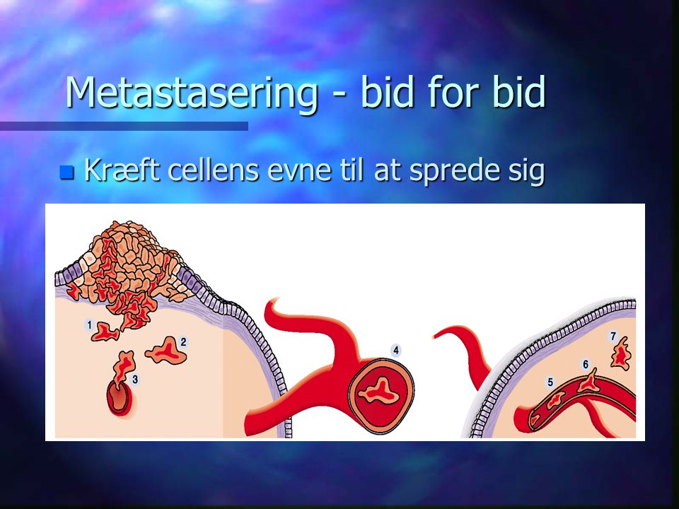 Metastasering - bid for bid