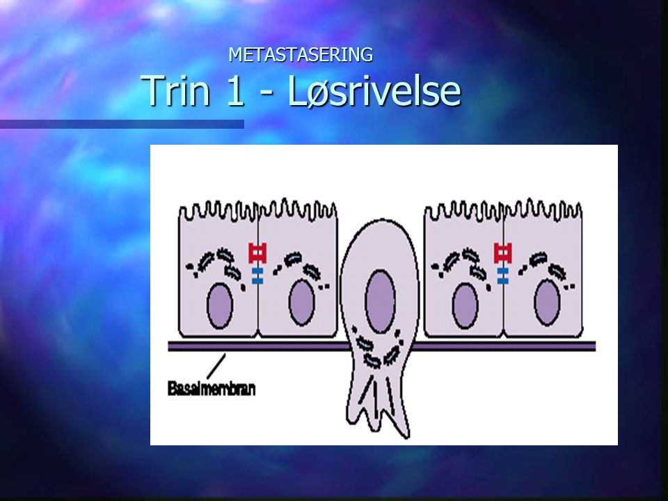 METASTASERING Trin 1 - Løsrivelse