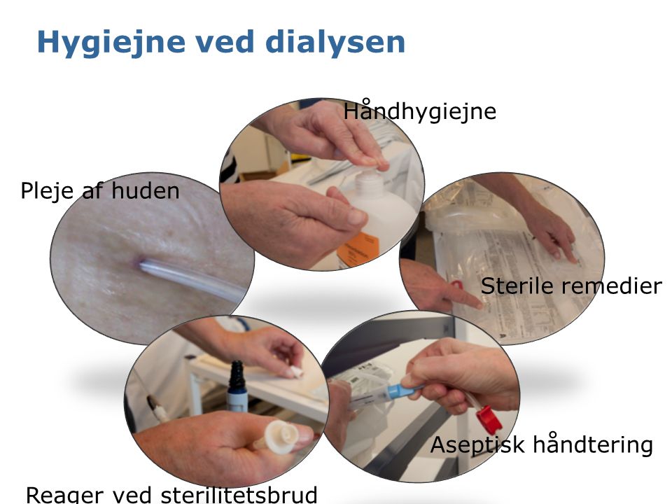 Hygiejne ved dialysen Håndhygiejne Pleje af huden Sterile remedier