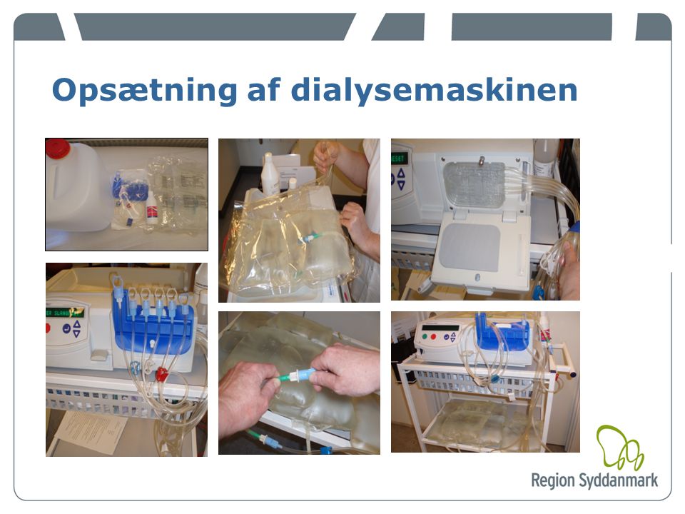 Opsætning af dialysemaskinen