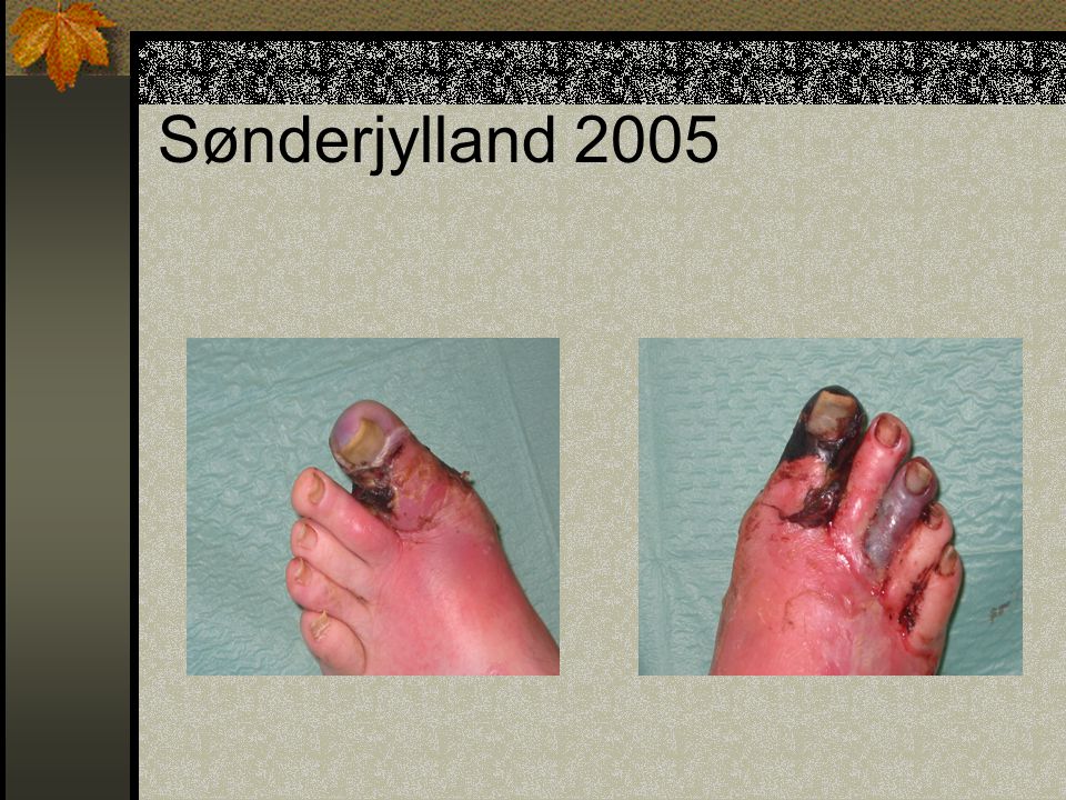 Sønderjylland 2005