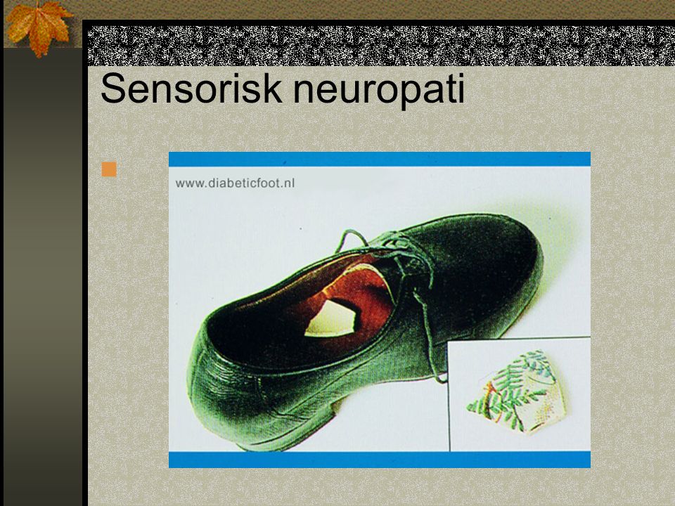 Sensorisk neuropati
