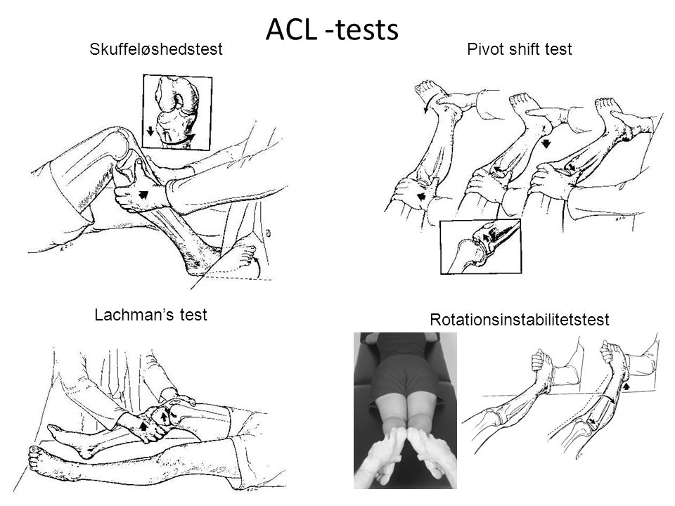 ACL -tests Skuffeløshedstest Pivot shift test Lachman’s test