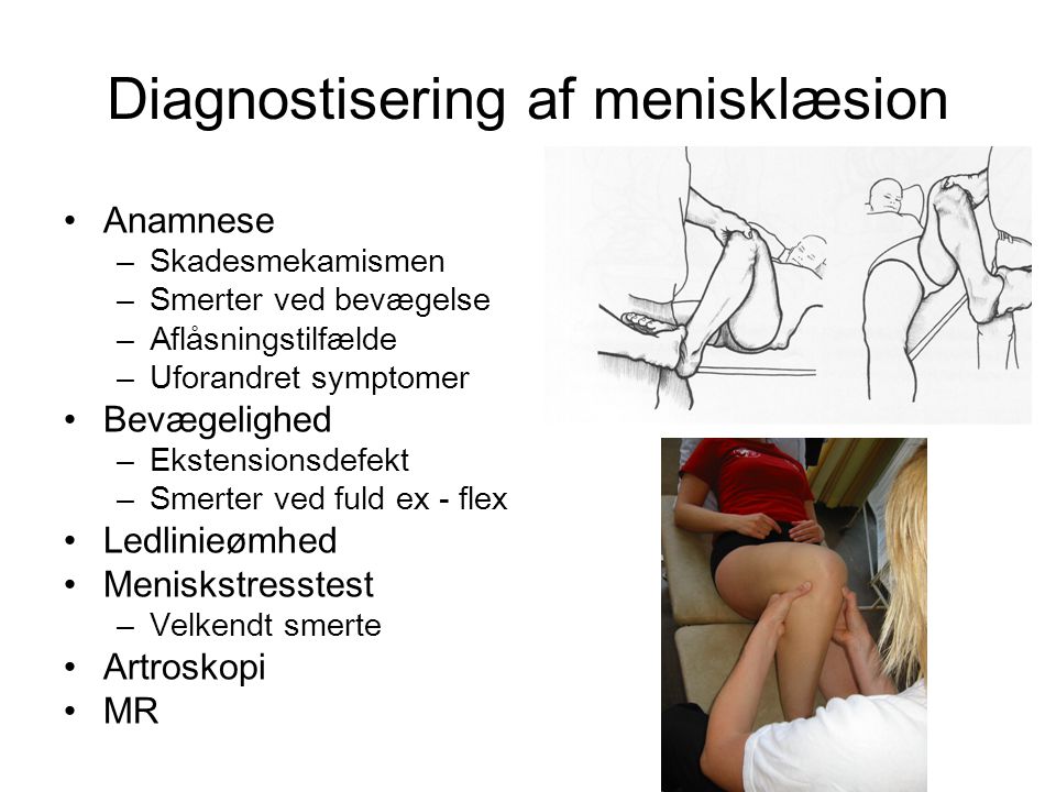 Diagnostisering af menisklæsion