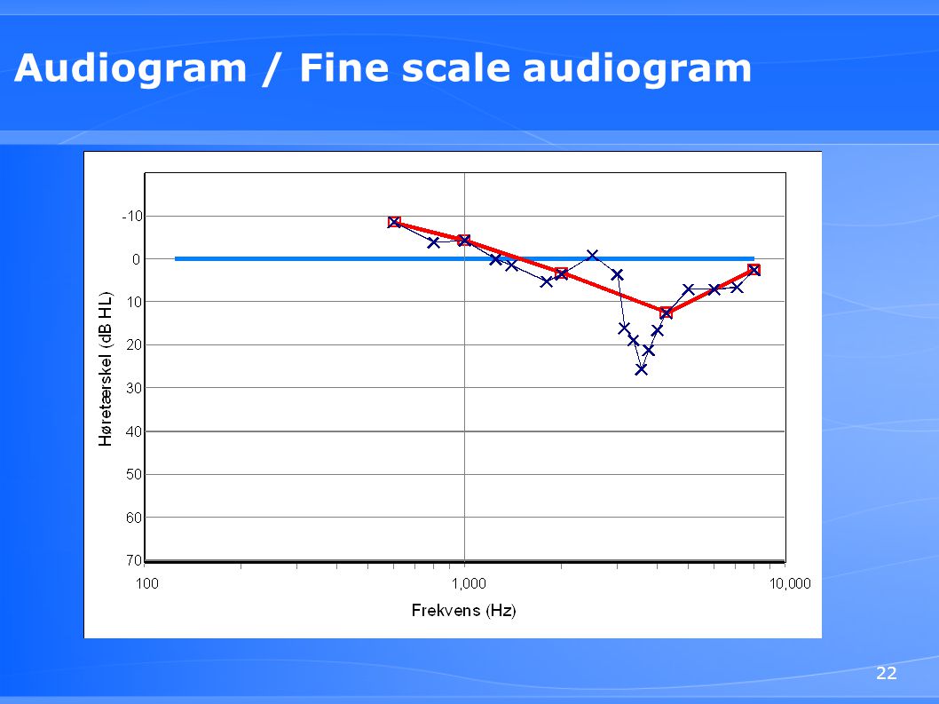Audiogram / Fine scale audiogram