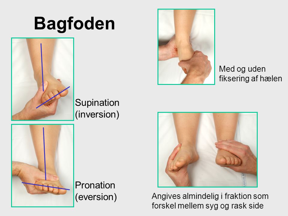Bagfoden Supination (inversion) Pronation (eversion)