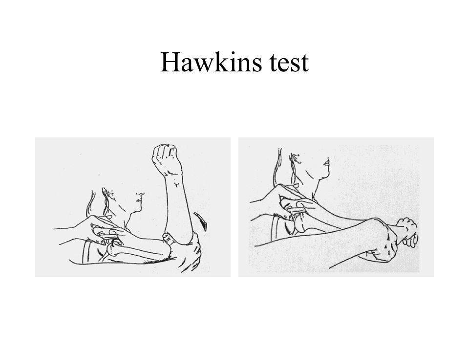 Hawkins test