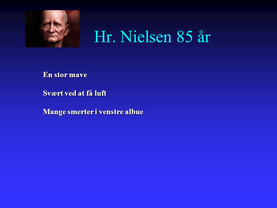 Hr. Nielsen 85 år En stor mave Svært ved at få luft