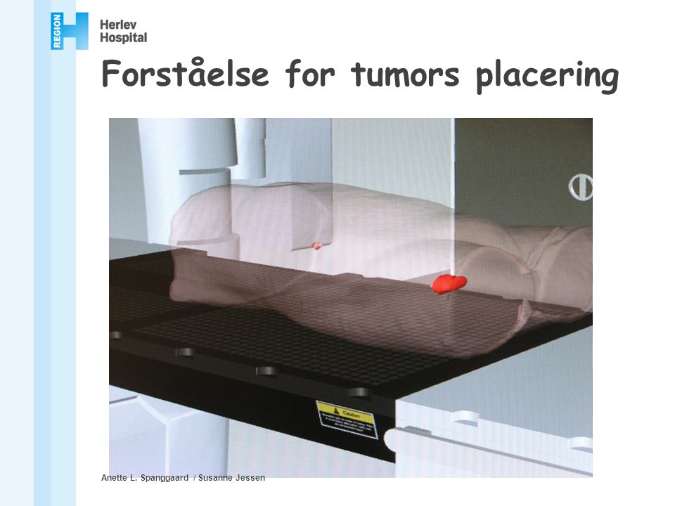 Forståelse for tumors placering