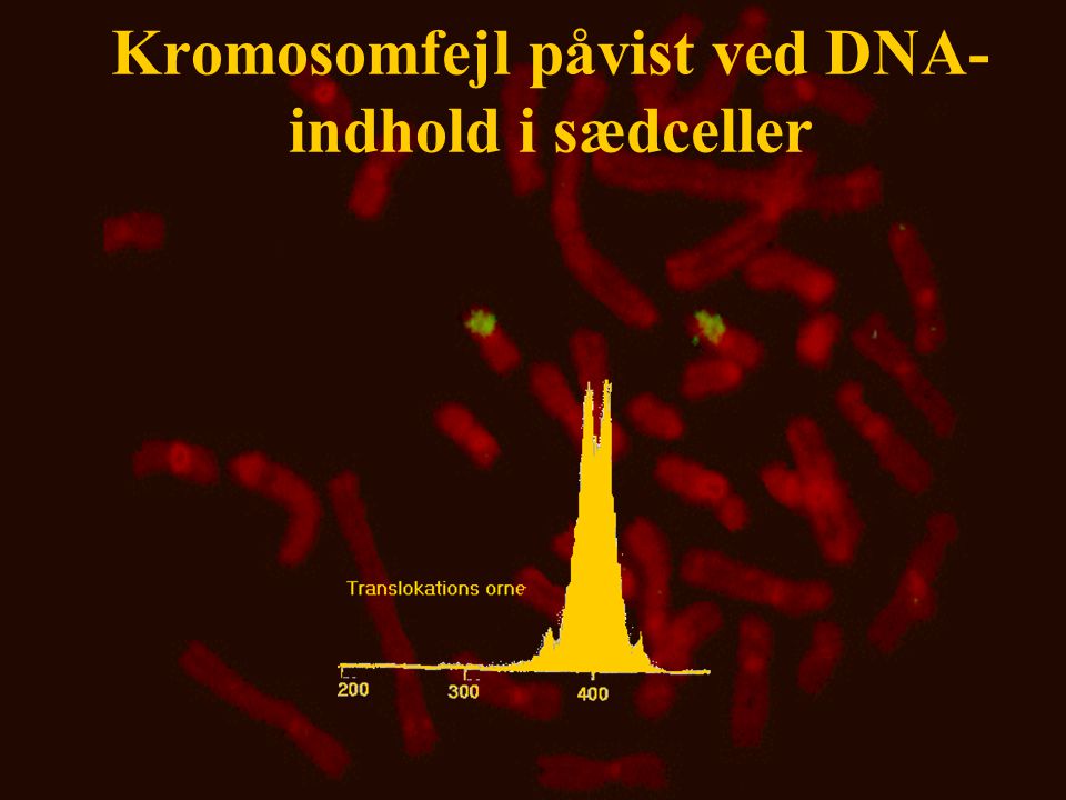 Kromosomfejl påvist ved DNA-indhold i sædceller