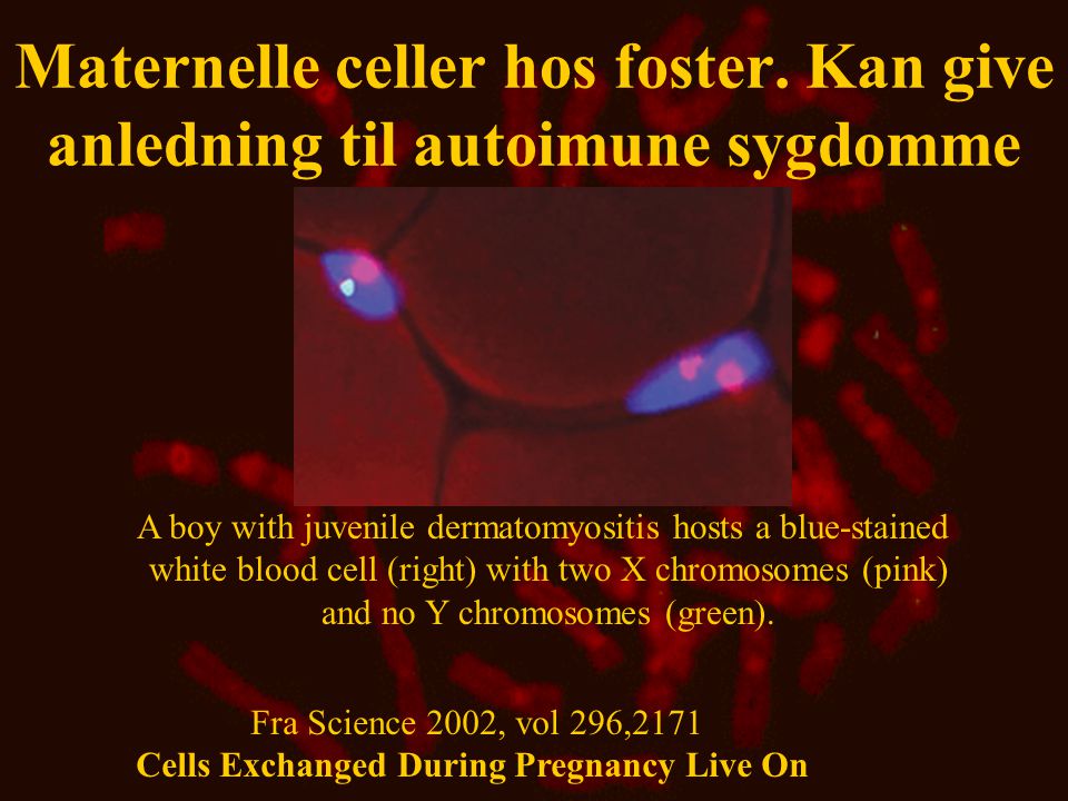 Maternelle celler hos foster. Kan give anledning til autoimune sygdomme