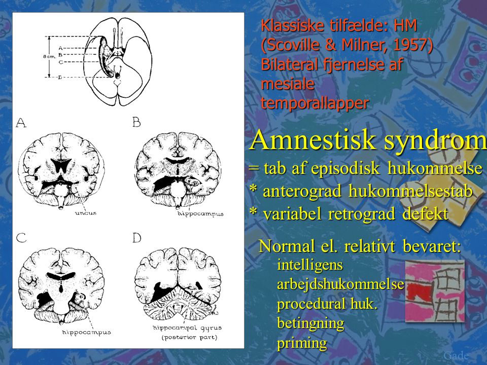 Amnestisk syndrom = tab af episodisk hukommelse