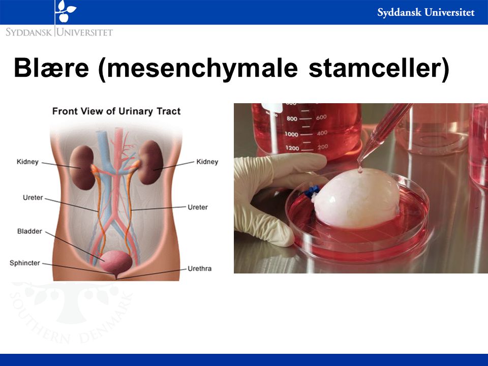 Blære (mesenchymale stamceller)