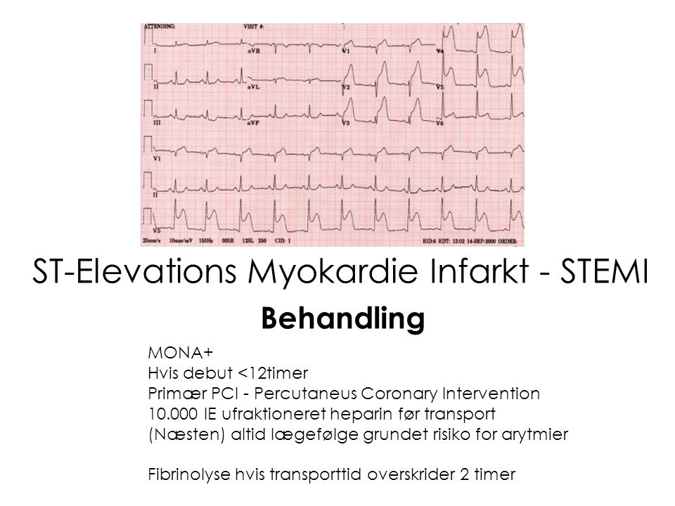 ST-Elevations Myokardie Infarkt - STEMI
