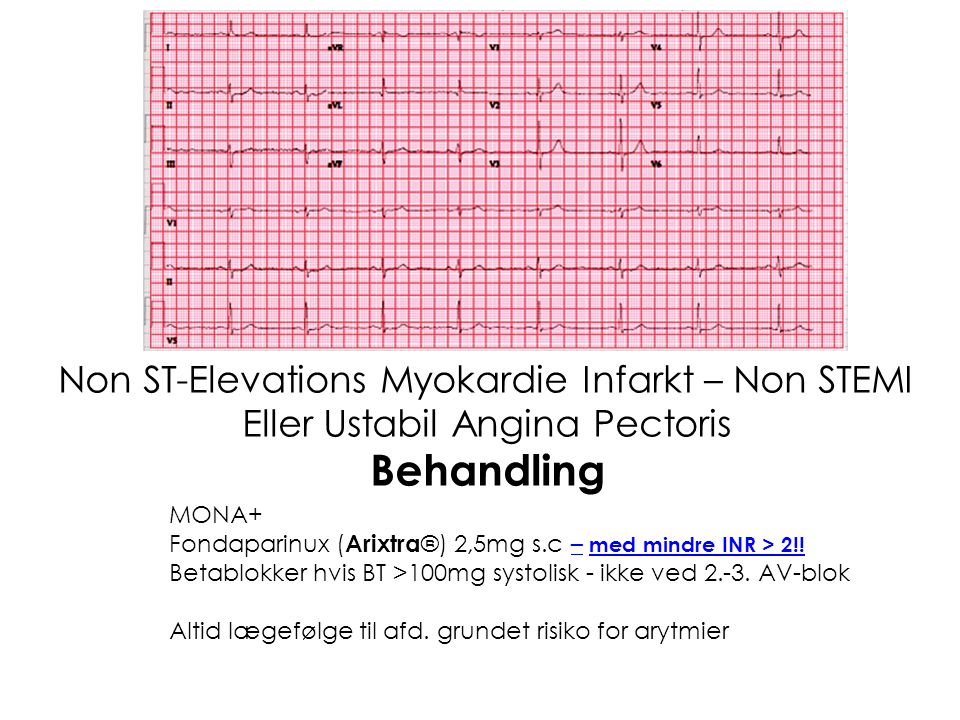 Behandling Non ST-Elevations Myokardie Infarkt – Non STEMI