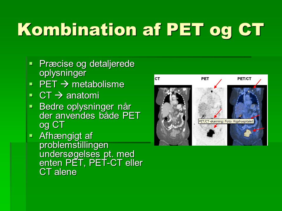 Kombination af PET og CT