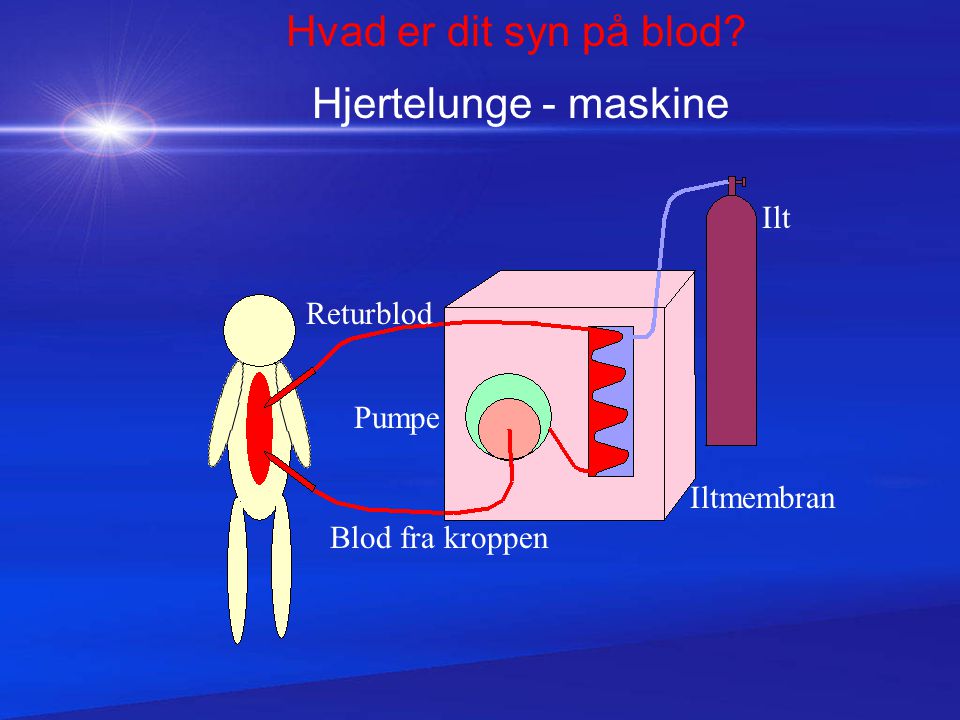 Hvad er dit syn på blod Hjertelunge - maskine Ilt Returblod Pumpe