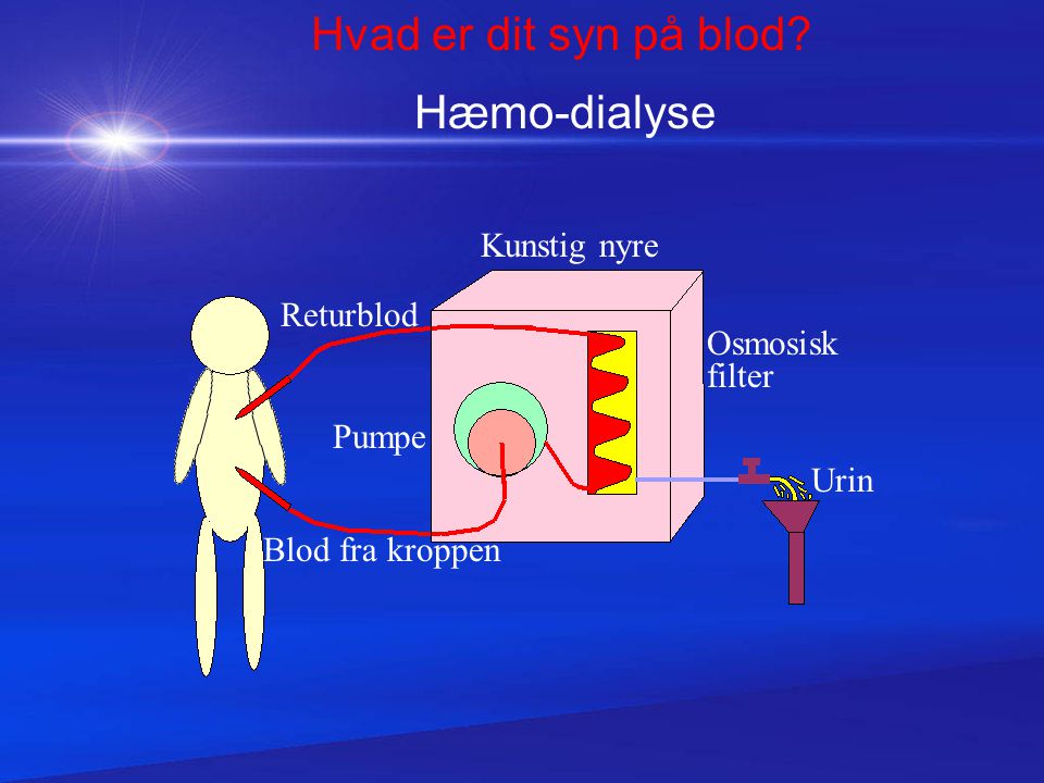 Hvad er dit syn på blod Hæmo-dialyse Kunstig nyre Returblod Osmosisk