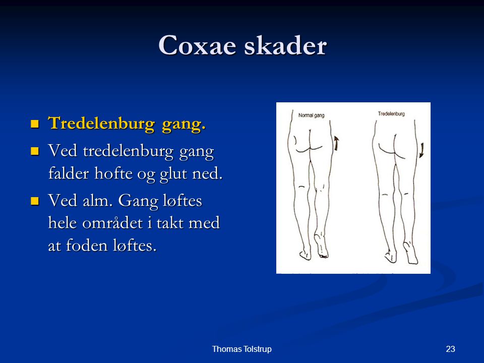 Coxae skader Tredelenburg gang.
