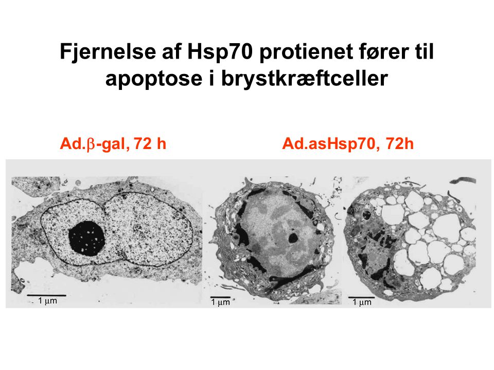 Fjernelse af Hsp70 protienet fører til apoptose i brystkræftceller
