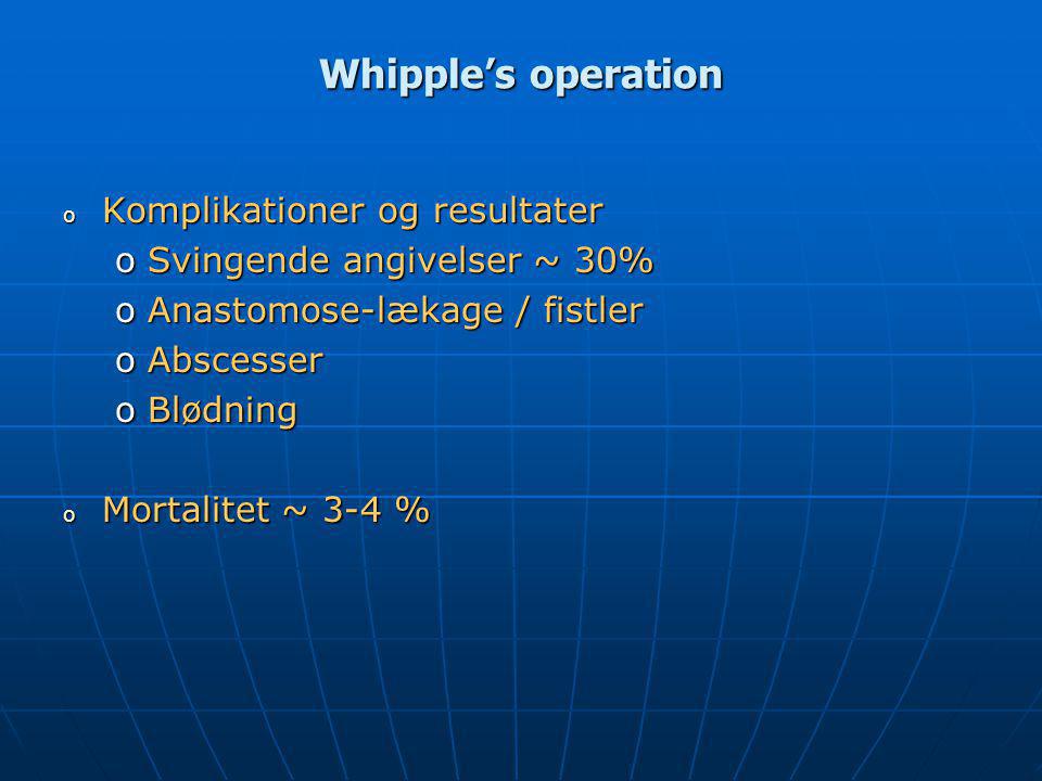 Whipple’s operation Komplikationer og resultater