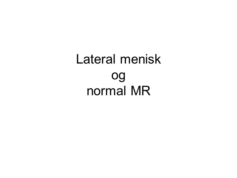 Lateral menisk og normal MR