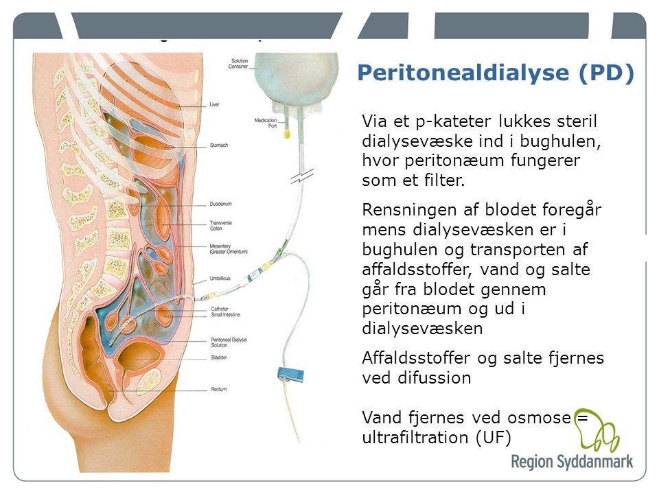 Peritonealdialyse (PD)