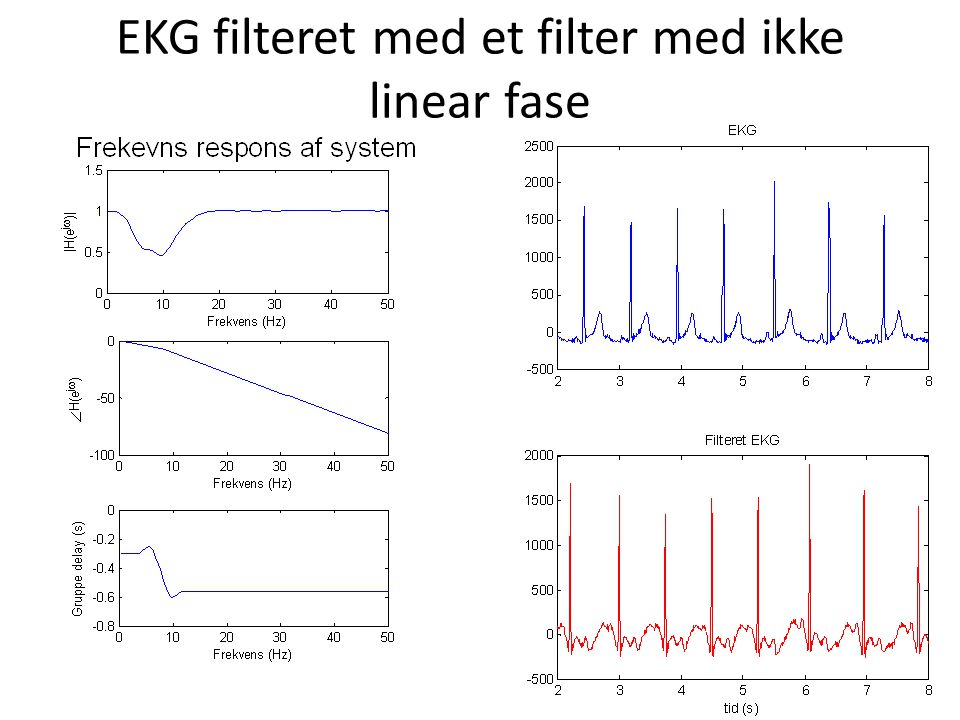 EKG filteret med et filter med ikke linear fase