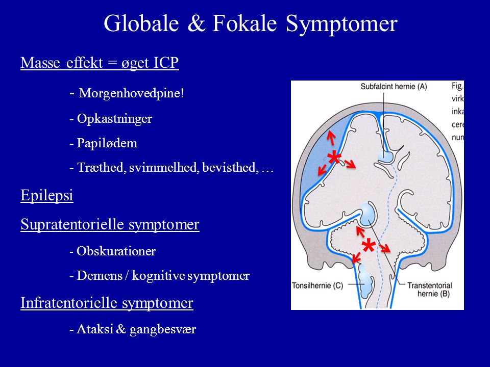 Globale & Fokale Symptomer